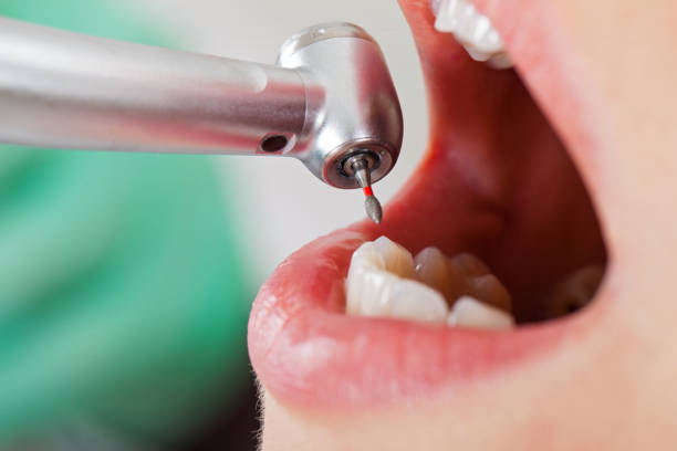 Best Emergency Treatment for Toothache in Alamo, TX